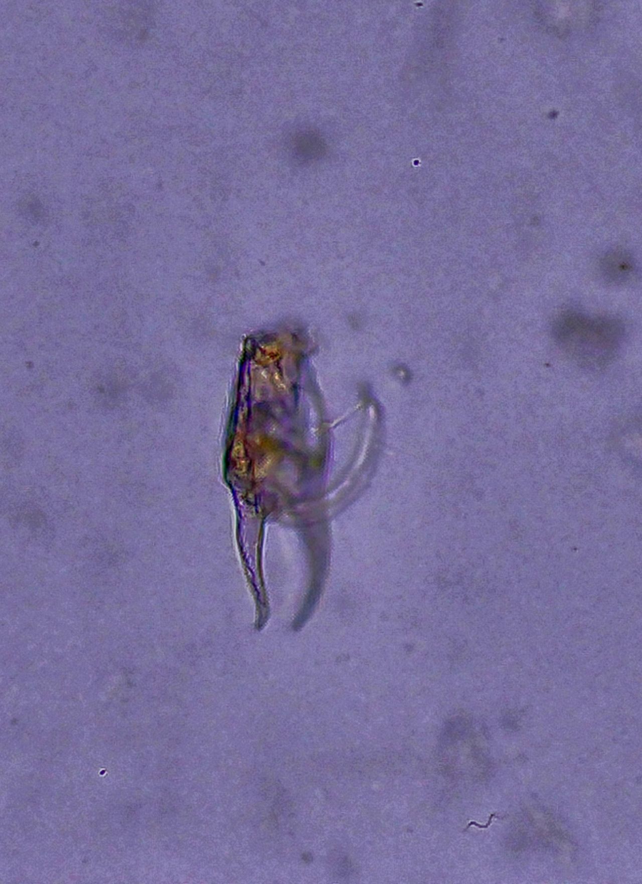 L�ingegnere idrodinamico dello stagno: alla scoperta del rotifero Brachionus